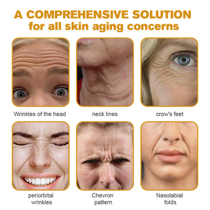 Made and Shipped from New Zealand 🇳🇿 AWZLOVE® 🐱‍💻Bee Venom Comprehensive Cream  LAST DAY 80% OFF 🌹