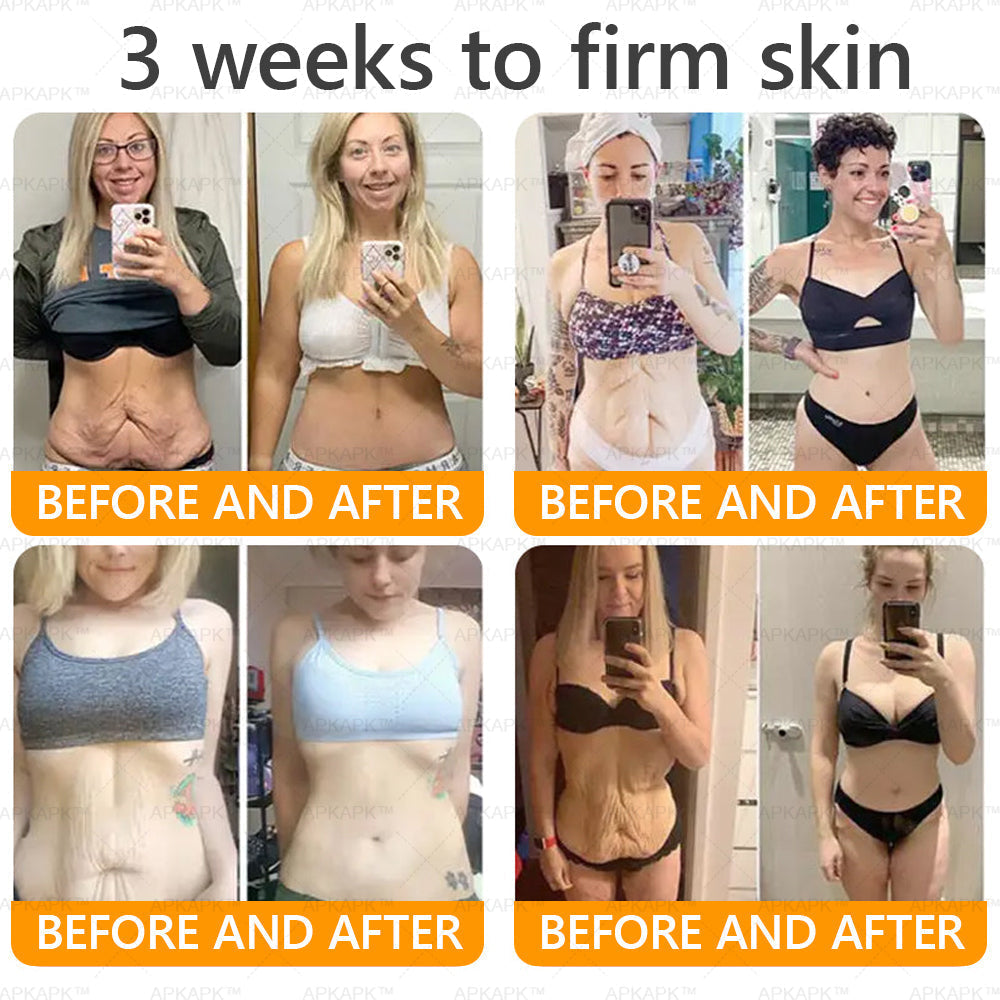 Made and Shipped from New Zealand 🇳🇿 AWZLOVE® 🐱‍💻Bee Venom Comprehensive Cream  LAST DAY 80% OFF 🌹