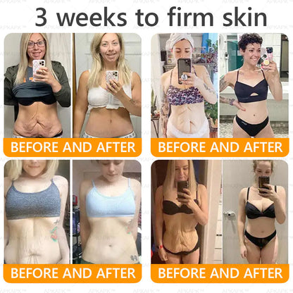 Made and Shipped from New Zealand 🇳🇿 AWZLOVE® 🐱‍💻Bee Venom Comprehensive Cream  LAST DAY 80% OFF 🌹