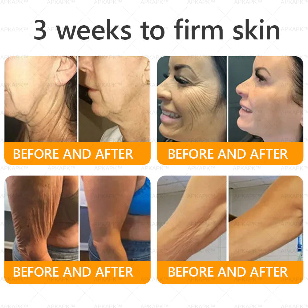 Made and Shipped from New Zealand 🇳🇿 AWZLOVE® 🐱‍💻Bee Venom Comprehensive Cream  LAST DAY 80% OFF 🌹