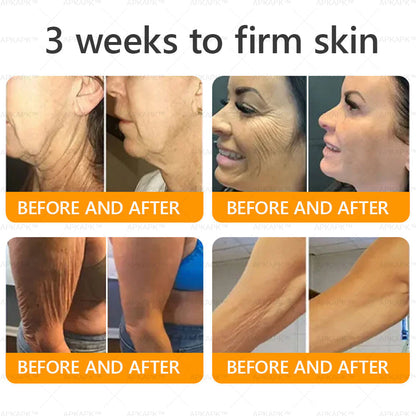 Made and Shipped from New Zealand 🇳🇿 AWZLOVE® 🐱‍💻Bee Venom Comprehensive Cream  LAST DAY 80% OFF 🌹